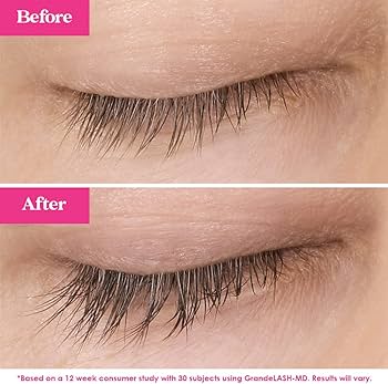 Sérum de Crescimento ♡ Grandlash